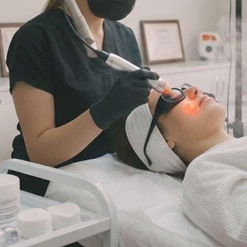 Lazer yüz bölgesi